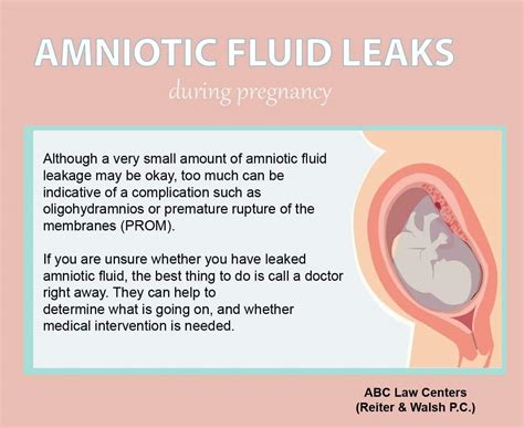 how to tell if leaking amniotic fluid|Leaking Amniotic Fluid: Signs, Causes, and。